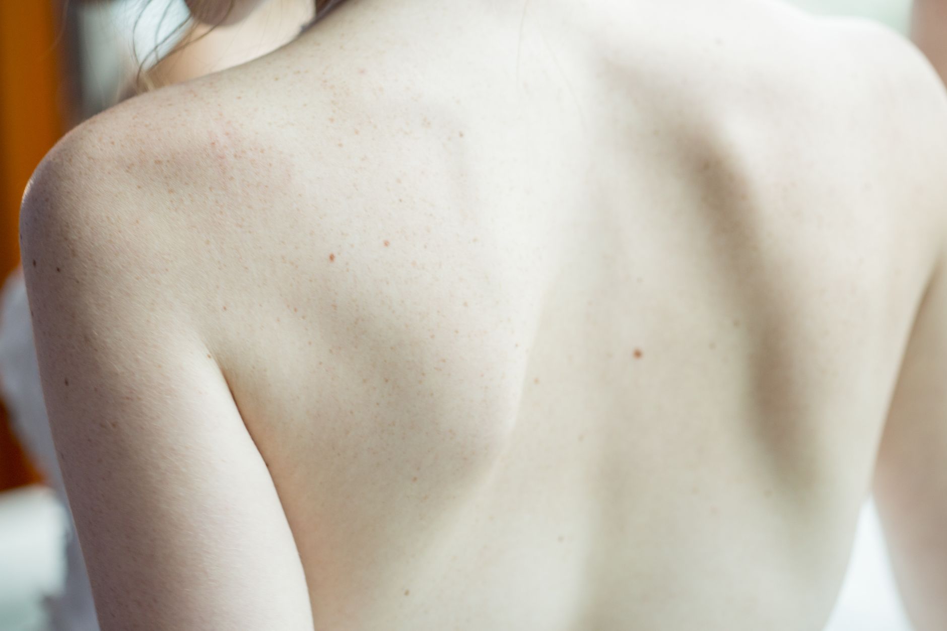 Two treatments can both be called HIFU - here is what separates them