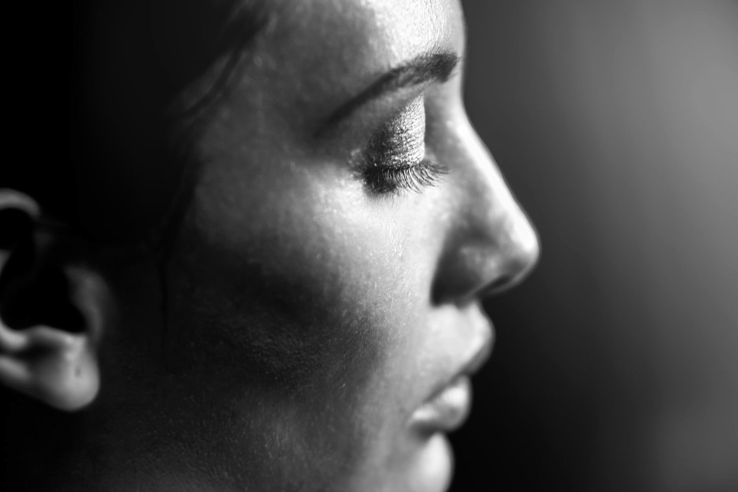 Dull, dehydrated skin