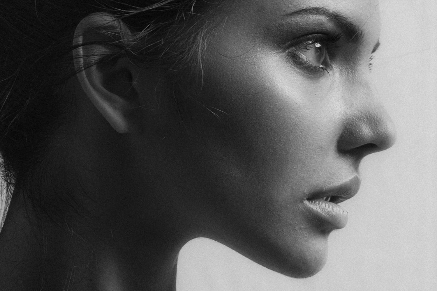 Skin laxity and firmness