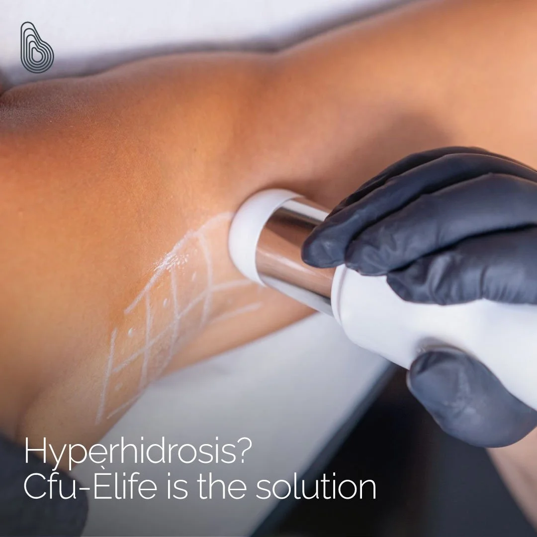 Focused ultrasound sweat-gland treatment in progress
