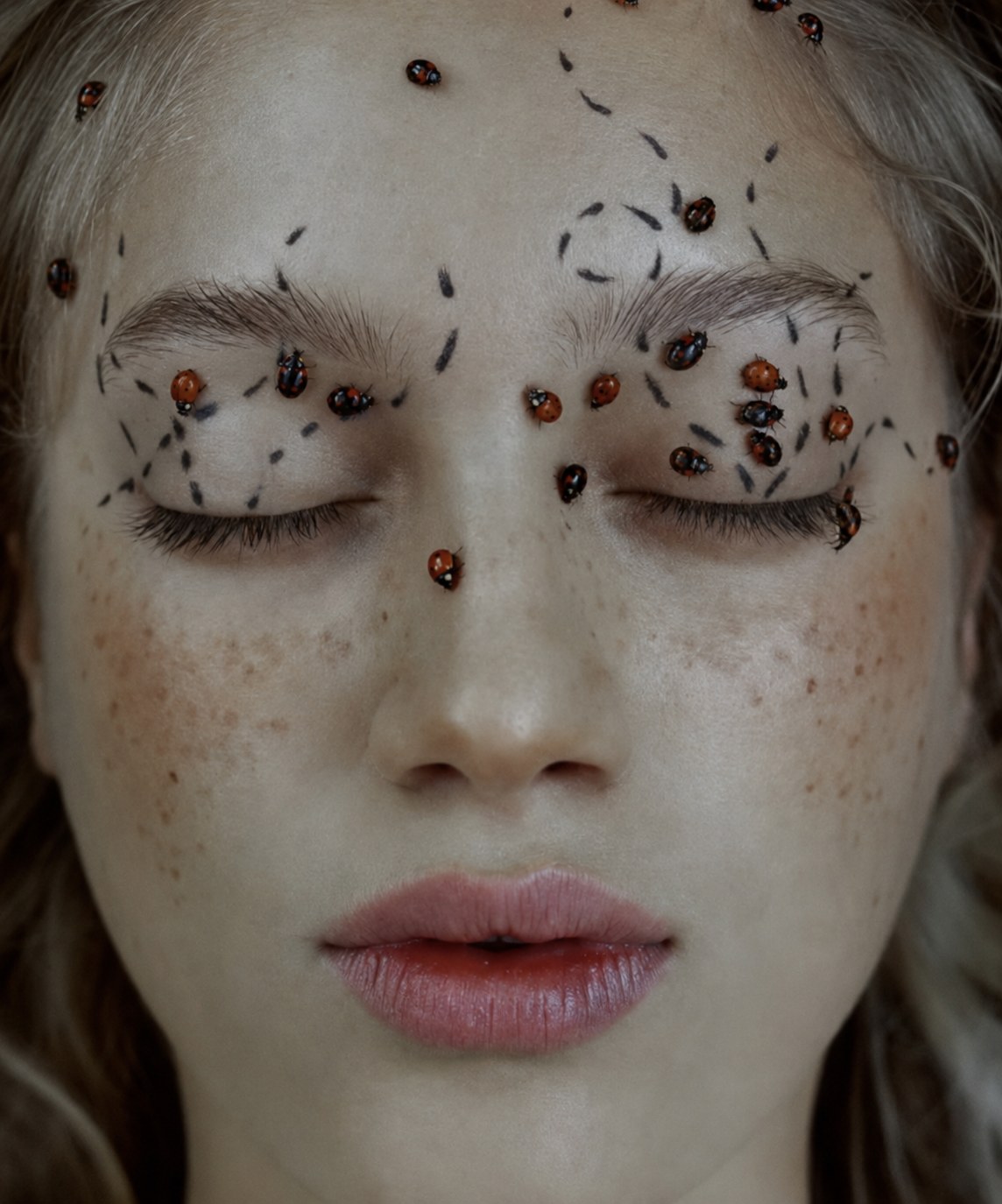 Moles & Skin Tag Removal at Skin Body Health