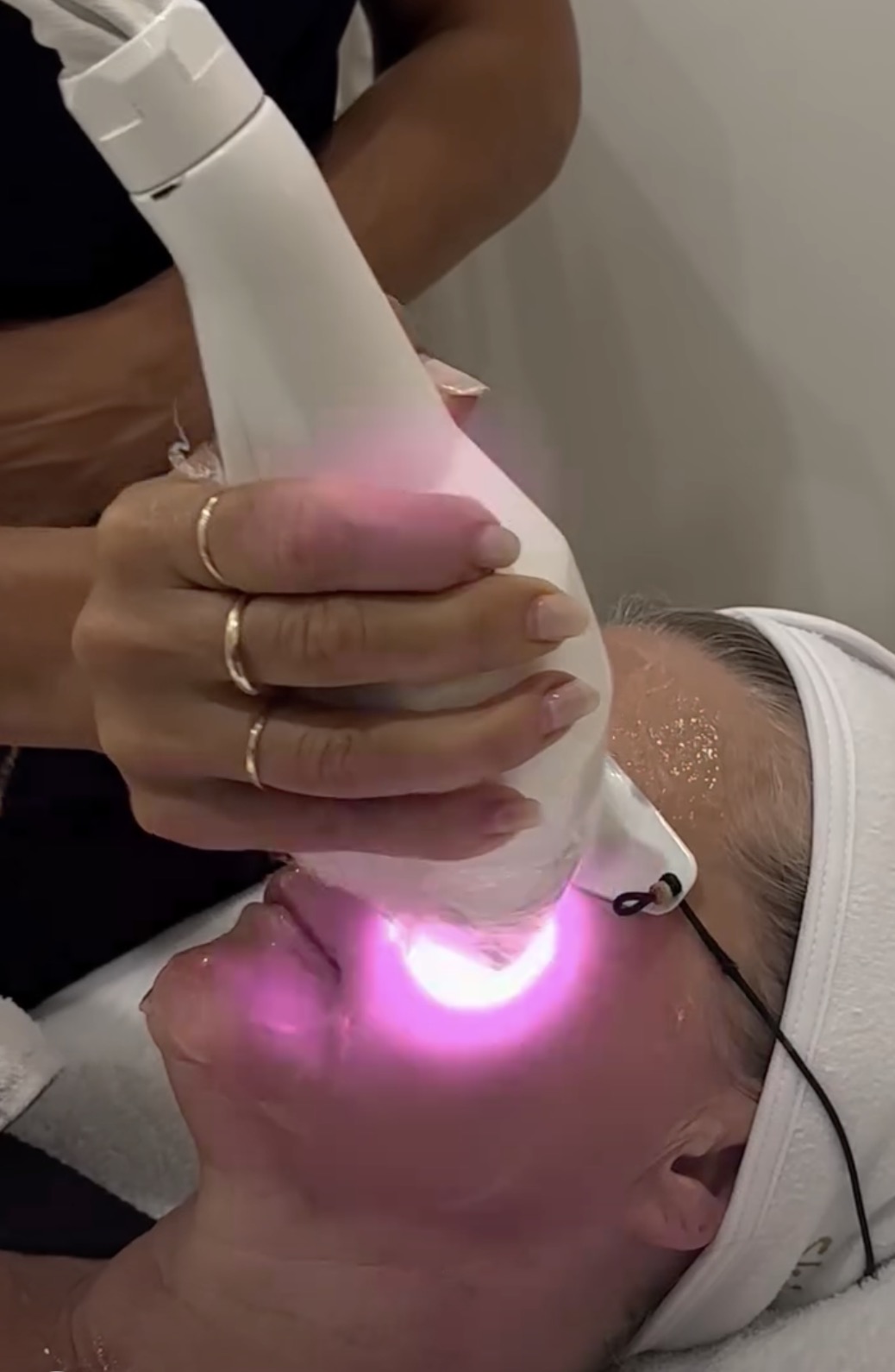 Skin rejuvenation treatment at Skin Body Health